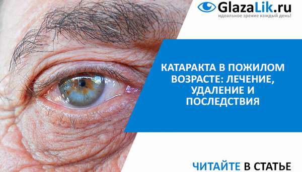 баннер для статьи о катаракте в пожилом возрасте